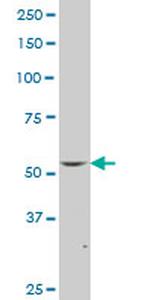 FLI1 Antibody in Western Blot (WB)