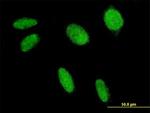 FLI1 Antibody in Immunocytochemistry (ICC/IF)