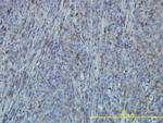 FLNA Antibody in Immunohistochemistry (Paraffin) (IHC (P))