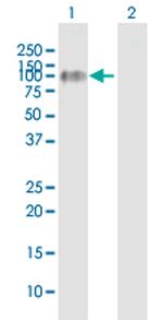 FLT1 Antibody in Western Blot (WB)