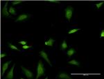 FNTB Antibody in Immunocytochemistry (ICC/IF)