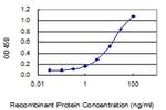 FOLH1 Antibody in ELISA (ELISA)