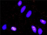 FOS Antibody in Proximity Ligation Assay (PLA) (PLA)