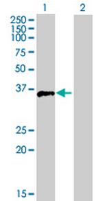 FOSB Antibody in Western Blot (WB)