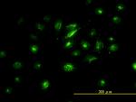 FOSL2 Antibody in Immunocytochemistry (ICC/IF)