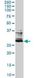 FOSL2 Antibody in Western Blot (WB)