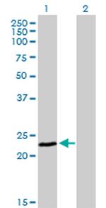 FXN Antibody in Western Blot (WB)