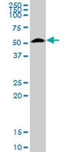 FUCA1 Antibody in Western Blot (WB)