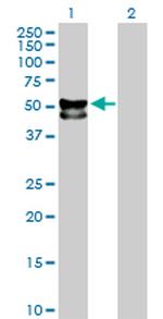 FUCA1 Antibody in Western Blot (WB)