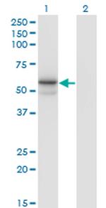 FUCA1 Antibody in Western Blot (WB)