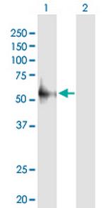 FYN Antibody in Western Blot (WB)