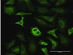 G6PD Antibody in Immunocytochemistry (ICC/IF)