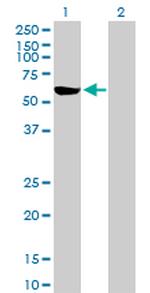 G6PD Antibody in Western Blot (WB)