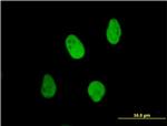 XRCC6 Antibody in Immunocytochemistry (ICC/IF)