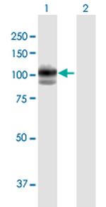 GAA Antibody in Western Blot (WB)