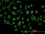 GABBR1 Antibody in Immunocytochemistry (ICC/IF)