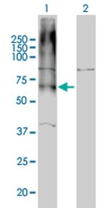 GABBR1 Antibody in Western Blot (WB)