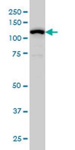 GABBR1 Antibody in Western Blot (WB)