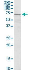 GAD2 Antibody in Western Blot (WB)