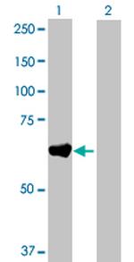 GAD2 Antibody in Western Blot (WB)