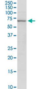 GAD2 Antibody in Western Blot (WB)