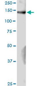 GAK Antibody in Western Blot (WB)