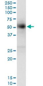 GAK Antibody in Immunoprecipitation (IP)