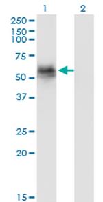 GAK Antibody in Western Blot (WB)