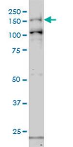 GAK Antibody in Western Blot (WB)