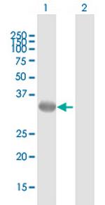 GALE Antibody in Western Blot (WB)