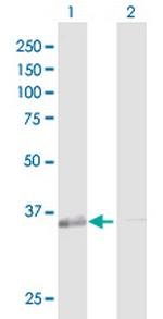 GALE Antibody in Western Blot (WB)