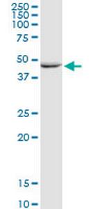 GALK2 Antibody in Western Blot (WB)