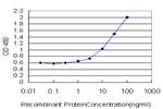 GALT Antibody in ELISA (ELISA)