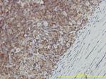 GALT Antibody in Immunohistochemistry (Paraffin) (IHC (P))