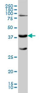 GALT Antibody in Western Blot (WB)