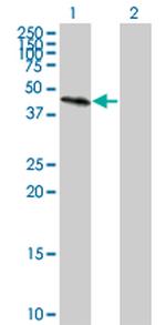 GALT Antibody in Western Blot (WB)