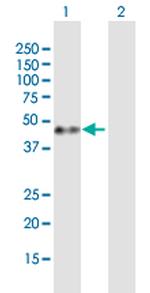 GAP43 Antibody in Western Blot (WB)