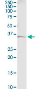 GAPDH Antibody in Immunoprecipitation (IP)