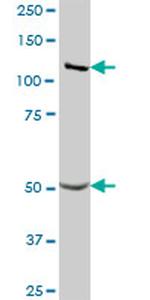 GART Antibody in Western Blot (WB)