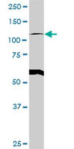 GART Antibody in Western Blot (WB)