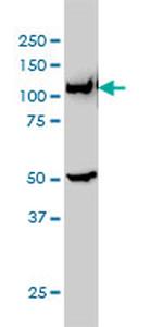 GART Antibody in Western Blot (WB)