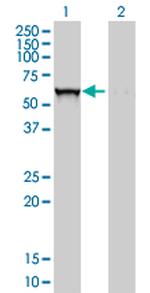 GBA Antibody in Western Blot (WB)