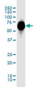 GBA Antibody in Western Blot (WB)