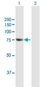 GBE1 Antibody in Western Blot (WB)