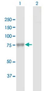 GBE1 Antibody in Western Blot (WB)