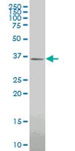 GBX2 Antibody in Western Blot (WB)