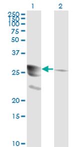 GCH1 Antibody in Western Blot (WB)