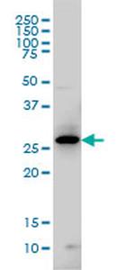 GCH1 Antibody in Western Blot (WB)