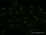 GCHFR Antibody in Immunocytochemistry (ICC/IF)