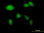 GCK Antibody in Immunocytochemistry (ICC/IF)